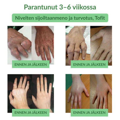 🔥Virallinen myymälä: Ourlyard® Chillflex Mint Kipua Lievittävä Voide (Hoito niveltulehdukseen, hermosärkyyn, reumasairauksiin, lihaskramppeihin, nykimisiin ja urheiluvammoihin)