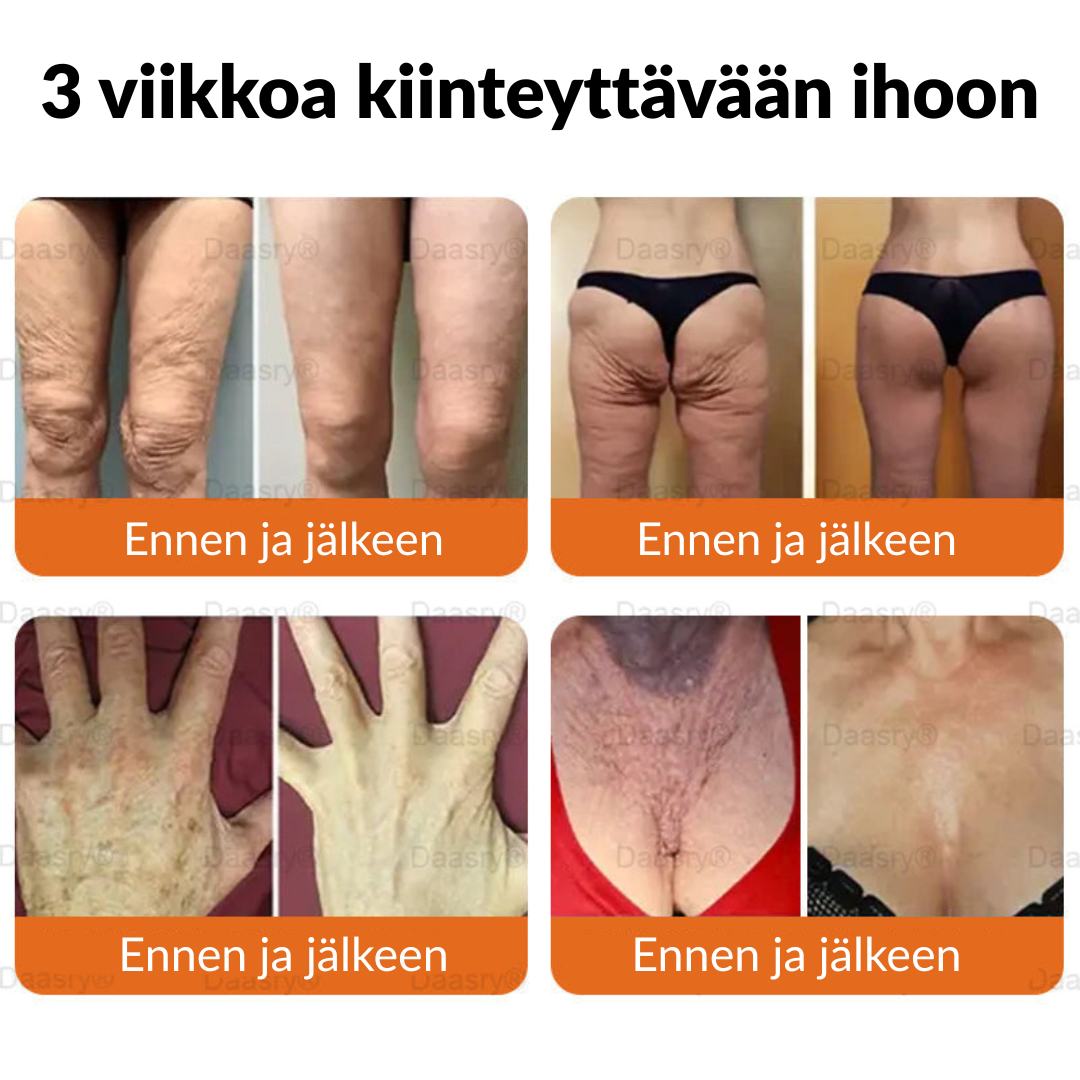 Ourlyard® Botox Mehiläismyrkky Ihon Uudistusvoide – Ikääntymisen merkkien vähentäjä, Kosteuttava, Ihoa kiinteyttävä ja kohottava, Ihon korjaava, Tasaisen sävyn edistäjä, Aknen ja tummien läiskien hoito, Syylien ja luomien poisto sekä Psoriaasin lievitys.