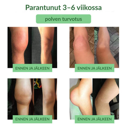 🔥Virallinen myymälä: Ourlyard® Chillflex Mint Kipua Lievittävä Voide (Hoito niveltulehdukseen, hermosärkyyn, reumasairauksiin, lihaskramppeihin, nykimisiin ja urheiluvammoihin)