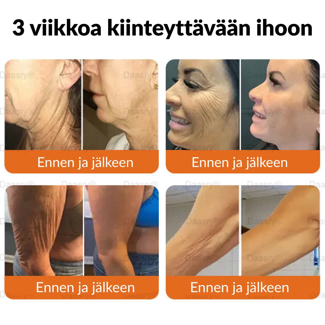 Ourlyard® Botox Mehiläismyrkky Ihon Uudistusvoide – Ikääntymisen merkkien vähentäjä, Kosteuttava, Ihoa kiinteyttävä ja kohottava, Ihon korjaava, Tasaisen sävyn edistäjä, Aknen ja tummien läiskien hoito, Syylien ja luomien poisto sekä Psoriaasin lievitys.