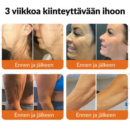 Ourlyard® Botox Mehiläismyrkky Ihon Uudistusvoide – Ikääntymisen merkkien vähentäjä, Kosteuttava, Ihoa kiinteyttävä ja kohottava, Ihon korjaava, Tasaisen sävyn edistäjä, Aknen ja tummien läiskien hoito, Syylien ja luomien poisto sekä Psoriaasin lievitys.