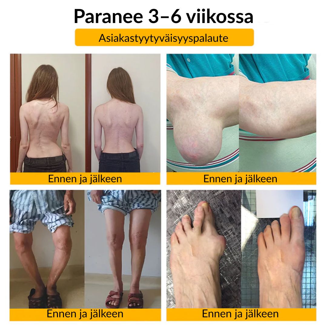 ⚡📢Ourlyard® Botuliinitoksiini ja Mehiläismyrkky Kipua Lievittävä ja Luita Parantava Kaksivaikutteinen Rauhoittava Voide