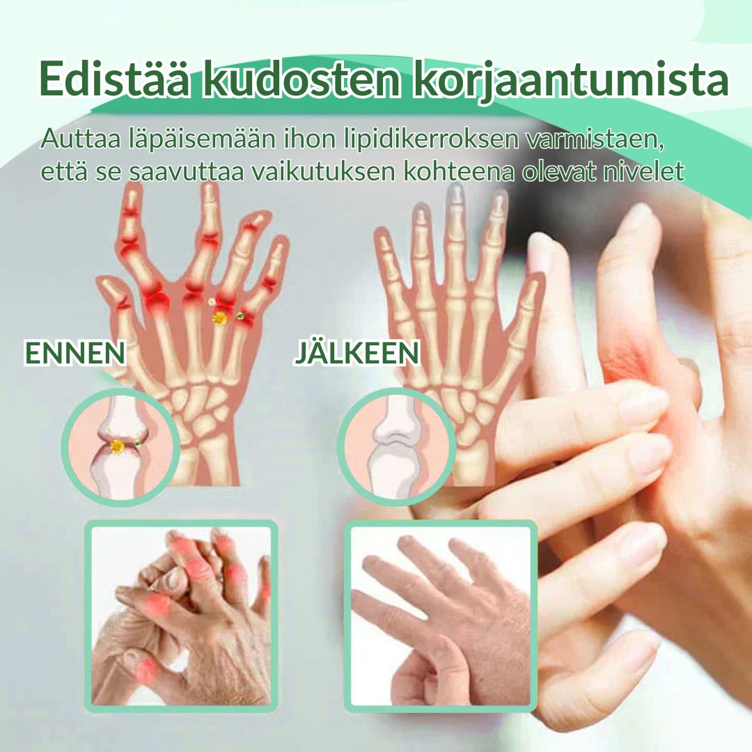 🔥Virallinen myymälä: Ourlyard® Chillflex Mint Kipua Lievittävä Voide (Hoito niveltulehdukseen, hermosärkyyn, reumasairauksiin, lihaskramppeihin, nykimisiin ja urheiluvammoihin)