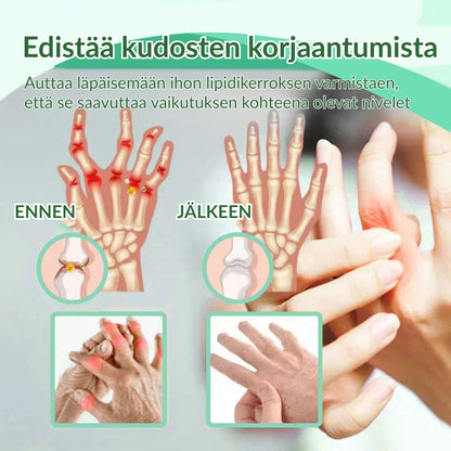 🔥Virallinen myymälä: Ourlyard® Chillflex Mint Kipua Lievittävä Voide (Hoito niveltulehdukseen, hermosärkyyn, reumasairauksiin, lihaskramppeihin, nykimisiin ja urheiluvammoihin)