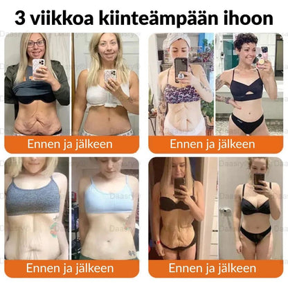 Ourlyard® Botox Mehiläismyrkky Ihon Uudistusvoide – Ikääntymisen merkkien vähentäjä, Kosteuttava, Ihoa kiinteyttävä ja kohottava, Ihon korjaava, Tasaisen sävyn edistäjä, Aknen ja tummien läiskien hoito, Syylien ja luomien poisto sekä Psoriaasin lievitys.