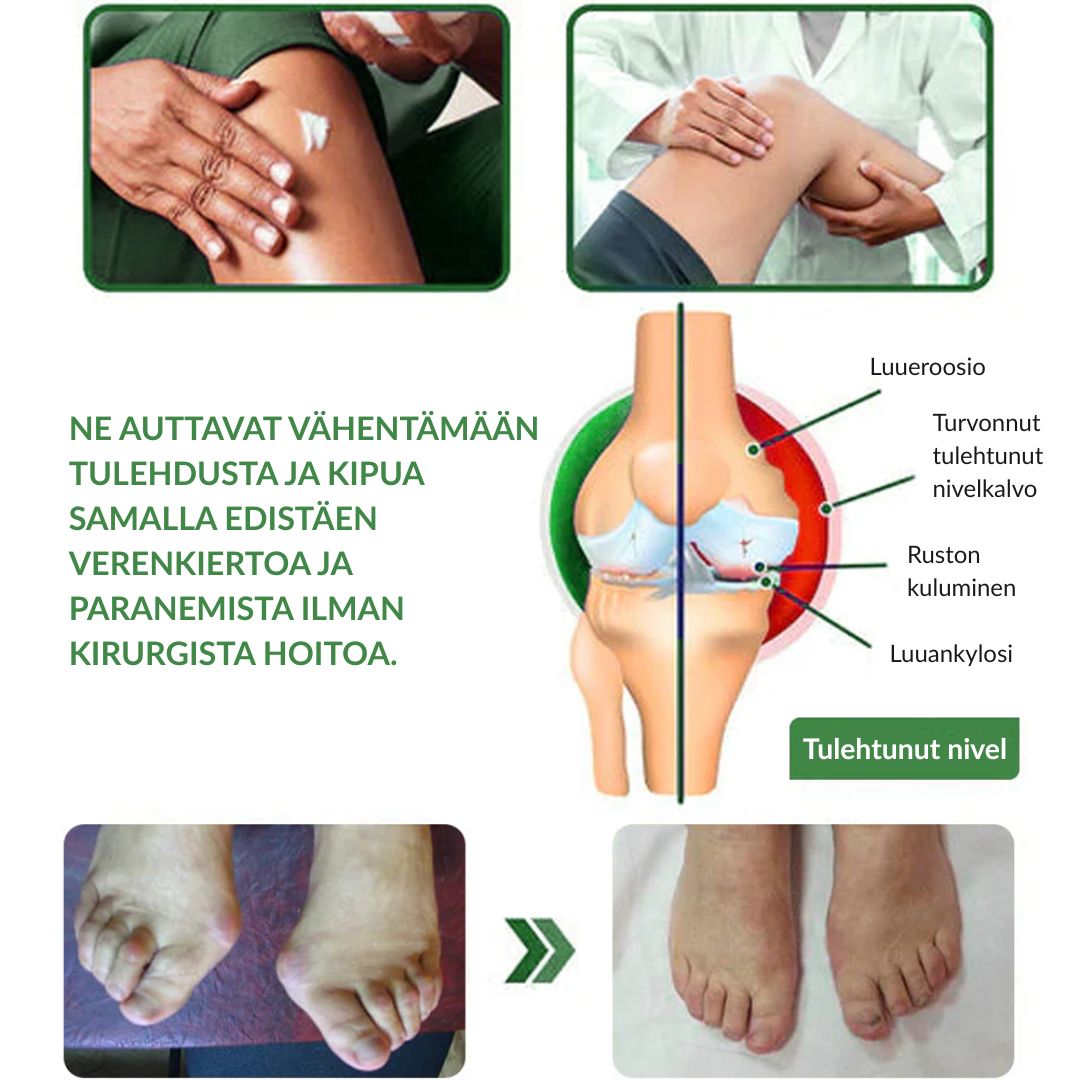 🔥Virallinen myymälä: Ourlyard® Chillflex Mint Kipua Lievittävä Voide (Hoito niveltulehdukseen, hermosärkyyn, reumasairauksiin, lihaskramppeihin, nykimisiin ja urheiluvammoihin)