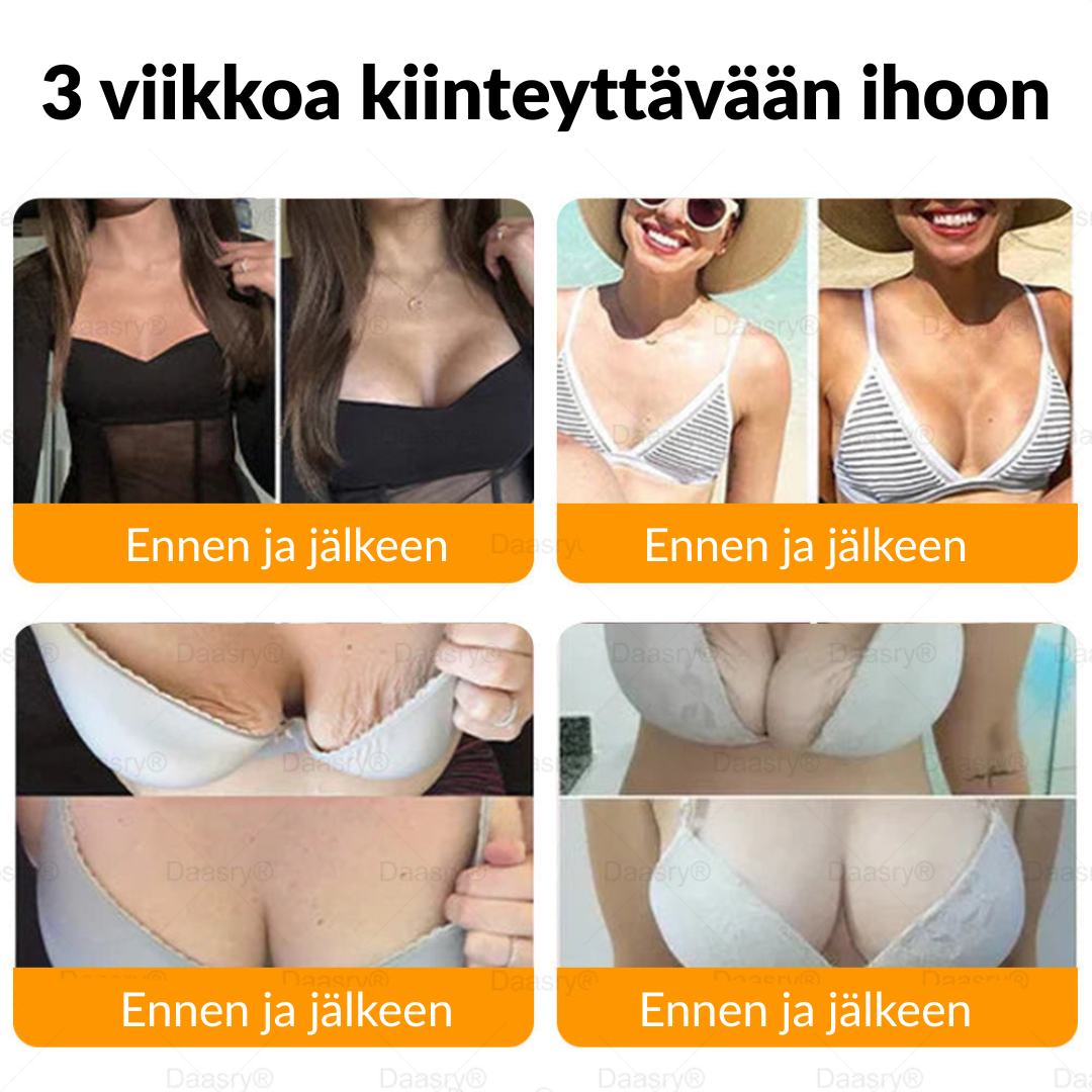 Ourlyard® Botox Mehiläismyrkky Ihon Uudistusvoide – Ikääntymisen merkkien vähentäjä, Kosteuttava, Ihoa kiinteyttävä ja kohottava, Ihon korjaava, Tasaisen sävyn edistäjä, Aknen ja tummien läiskien hoito, Syylien ja luomien poisto sekä Psoriaasin lievitys.