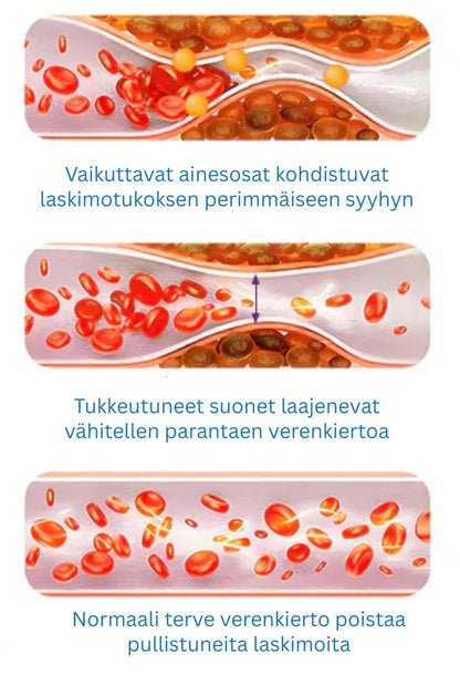 🔥Aikarajoitettu tarjous – Ourlyard® Vein Ease -mikroneulahoitolaastari – leikattava (hämähäkkisuonille, suonikohjuille, turvotukseen ja jalkojen väsymykseen)