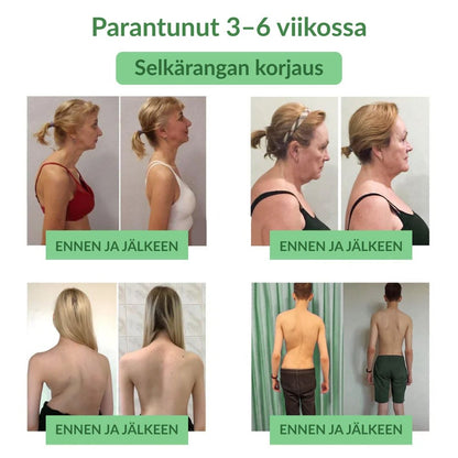 🔥Virallinen myymälä: Ourlyard® Chillflex Mint Kipua Lievittävä Voide (Hoito niveltulehdukseen, hermosärkyyn, reumasairauksiin, lihaskramppeihin, nykimisiin ja urheiluvammoihin)