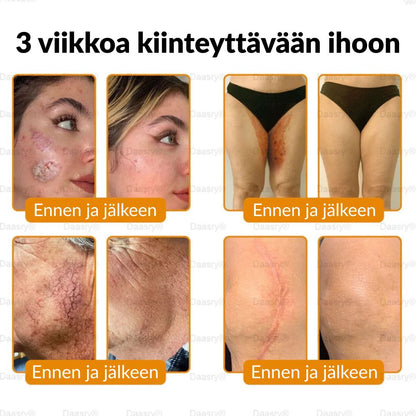 Ourlyard® Botox Mehiläismyrkky Ihon Uudistusvoide – Ikääntymisen merkkien vähentäjä, Kosteuttava, Ihoa kiinteyttävä ja kohottava, Ihon korjaava, Tasaisen sävyn edistäjä, Aknen ja tummien läiskien hoito, Syylien ja luomien poisto sekä Psoriaasin lievitys.
