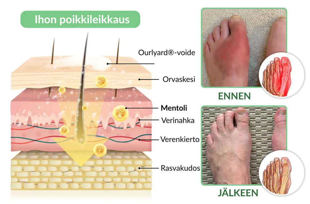 🎁𝐎𝐟𝐟𝐢𝐜𝐢𝐚𝐥 𝐒𝐭𝐨𝐫𝐞: 𝐎𝐮𝐫𝐥𝐲𝐚𝐫𝐝® Chillflex Mint Kivunlievitysvoide Vallankumouksellinen FDA:n hyväksymä voide poistaa kroonisen kivun vain 48 tunnissa – ei pillereitä, ei tuhansien eurojen lääkärikuluja!